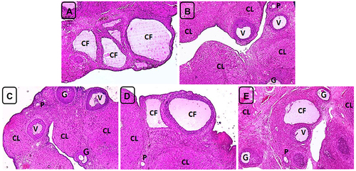 Figure 7 Ovarian sections of the positive control (PC) and treatment groups rats on day 40. (A) PC group showing persistence of cystic follicles and absence of corpora lutea. (B and C) Groups 3 (treatment control, Met 300 mg/Kg) and 6 (combination of Sil 100 mg/Kg and Met 300 mg/Kg) exhibiting absence of cystic follicles, resuming the occurrence of multiple corpora lutea (CL) and presence of antral follicles at different growth phases including primary (P), growing (G) and vesicular (V) follicles and disappearance of the cortical stromal inflammation. (D and E) Groups 4 and 5 (Sil 100 mg/Kg and Sil 200 mg/Kg BW respectively) showing few cystic follicles (CF), resuming the occurrence of corpora lutea (CL) and appearance of antral follicles at different growth phases and disappearance of the cortical stromal inflammation H&E, X100.
