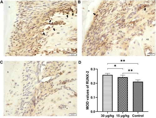 Figure 11 Expression of RUNX2 in the tension side of distopalatal root of maxillary molar.