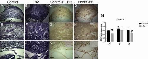 Figure 5. Photomicrographs of the transverse sections of the mice utero-placental units on gestation day (GD) 10.5 from control (a, e, i, c, g, k) and RA treated (b, f, j, d, h, l) groups. (a, e, i) Histology of the developed utero-placental unit from the control group showing, reduction of the thickness of decidual basalis (DB), and increase of the thickness of both junctional zone (JZ) and labyrinth zone (LB) comparing to the previous stage (GD9.5). (e) a magnified part of the decidual basalis and junctional zone (JZ). (i) a magnified part of labyrinth zone. (b, f, and j) Showing effect of RA treatment on the utero-placental development, note that irregular shape of placenta with inhibition of the development of both the junctional and labyrinth zones (Hx & E staining). (c, g, and k) illustrate the immunohistochemical localization of EGFR of the utero-placental unit from control group, note that EGFR is expressed at high level in the decidual basalis and the junctional zone, and at moderate level in the labyrinth zone. (d, h, l) showing the effect of RA on the expression level of EGFR. note that EGFR is expressed at moderate level in the decidual basalis and the giant cell layer of junctional zone, while the rest of junctional zone and labyrinth zone are devoid of immunoreaction. (m) Optical density of EGFR-positive areas in decidual basalis (DB), junctional zone (JZ) and labyrinth zone (LB). Density is expressed as the number of positive areas. **P < 0.01 compared with the control group. Blood sinuses (BS). Scale bar (a–d): 100 µm, (e–l): 50 µm.