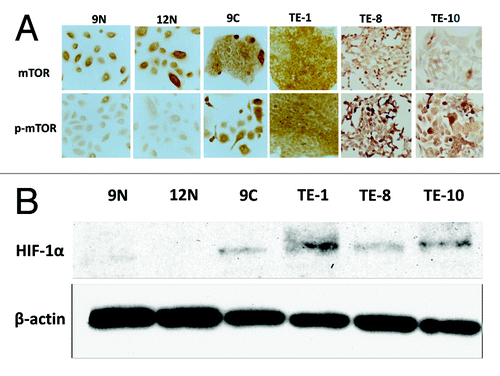 Figure 2. The activation of mTOR and its downstream effector is increased in esophageal cancer cell lines. (A) The expression status of mTOR (upper panels) and phosphorylated mTOR (lower panels) was determined in human primary normal esophageal epithelial cells (KOB9N and KOB12N) and in human esophageal cancer cell lines (KOB9C, TE-1, TE-8 and TE-10). (B) The expression of hypoxia inducible factor-1α (HIF-1α), a downstream effector of mTOR, was compared between in human primary normal esophageal epithelial cells (KOB9N and KOB12N) and in human esophageal cancer cell lines (KOB9C, TE-1, TE-8 and TE-10) by western blot.