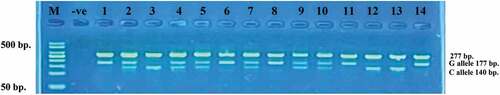 Figure 1. Agarose gel electrophoresis for the tetra primer-ARMS PCR product for genotyping rs2010963 SNP. (75 V for 60 min, M: DNA marker 50–500 bp, 2% Agarose).