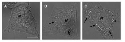 Figure 6 Photomicrographical images of NIH 3T3 cells cultured with chitosan–alginate core-shell nanoparticles at various times. Images were taken after (a) 0 hours, (b) 24 hours, and (c) 48 hours. The nanoparticles ingested into the endosomal compartments elicited the osmotic-swelling process over the period of cultivation. Arrows indicate the location of swollen vacuoles harboring chitosan–alginate core-shell nanoparticles probably undergoing erosion. N = nucleus. Scale bar = 5 μm.