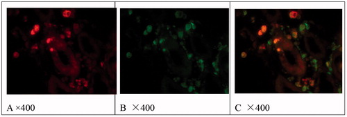 Figure 2. Localization of CD68 (B) and CD163 (A) and co-localization of CD68 and CD163 (C) in tubulointerstitial lesions of pSS. Immunofluorescence results.