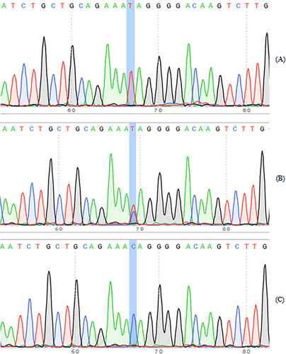 Figure 2 PCR products were sequenced for rs1805018 loci of PLA2G7 gene polymorphism. (A) rs1805018-T/T; (B) rs1805017-C/T; (C) rs1805017-C/C.