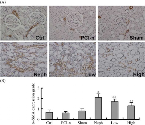 Figure 7.  Immunohistochemical staining of α-SMA protein in different groups of rats. (A) Staining of injured renal tissues by α-SMA antibody (200×). (B) Quantification of α-SMA expression. α-SMA expression was the strongest in the Neph group. Ctrl, control group; PCI-n, PCI-neo group; Sham, sham-operation group; Neph, 5/6 nephrectomy group; Low, low-dose PCI-neo-HGF group; High, high-dose PCI-neo-HGF group. *p < 0.05 versus Ctrl group; **p < 0.05 versus Neph group.