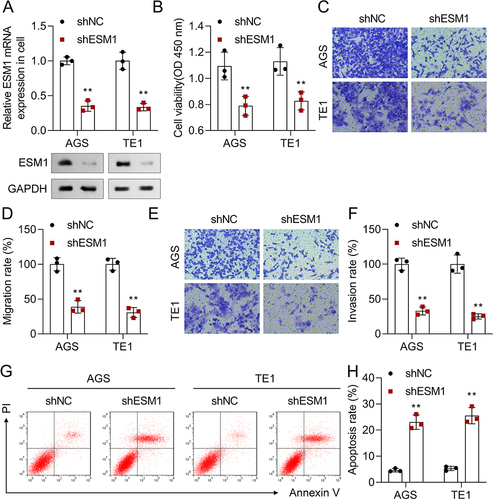 Figure 7 Silencing ESM1 decreased the cell viability, migration, and invasion and increased the apoptosis rate in AGS and TE1 cells. (A) The ESM1 mRNA and protein levels in AGS and TE1 cells after ESM1 inhibition were assessed by RT-qPCR and Western blot; (B) The cell viability in AGS and TE1 cells when ESM1 was inhibited was detected by CCK-8 assay; (C) Transwell migration assay was used to detect AGS and TE1 cell migration after silencing of ESM1; (D) The migration rate in shNC and shESM1 groups in AGS and TE1 cells; (E) The invasion of AGS and TE1 cells was analyzed by transwell invasion assay; (F) The invasion rate in shNC and shESM1 groups in AGS and TE1 cells; (G) Flow cytometry was performed to detect the apoptosis of AGS and TE1 cells; (H) The apoptosis rate in shNC and shESM1 groups in AGS and TE1 cells. (**p<0.01).