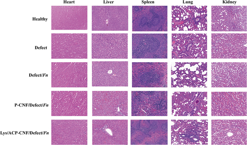 Figure 9 The Histological staining of major organs (heart, liver, spleen, lung, and kidney) in different group of rat for 8 weeks.