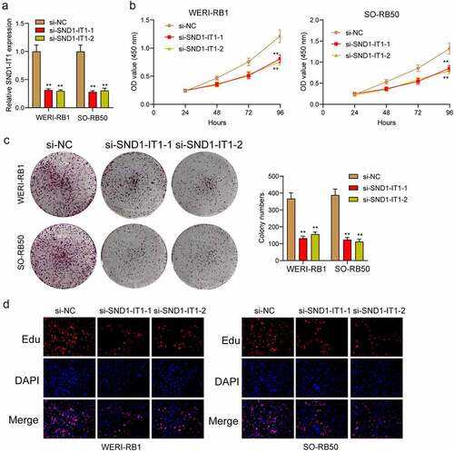 Figure 2. SND1-IT1 promoted proliferation of RB cells. (a) qRT-PCR analysis of the effect on inhibition of si-SND1-IT1 transfection in WERI-RB1 and SO-RB50 cell lines. (b) Cell proliferation was determined by CCK-8 assays. (c) Clone formation assays was used to detect cell proliferation in RB cells. (d) EdU immunofluorescence staining assays for WERI-RB1 and SO-RB50 cells. **p < 0.01, *p < 0.05