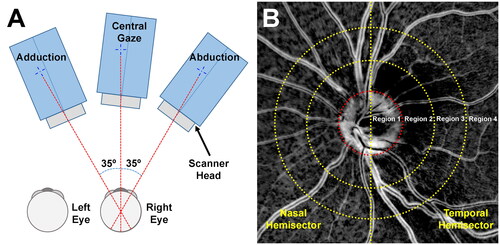 Figure 1. (A) Schematic of image acquisition. (B) Images were divided into eight analytic different zones, consisting of four radially defined regions and two defined nasal and temporal hemisectors. Region 1 represents the optic disc. Each concentric region was a multiple of disc radius.