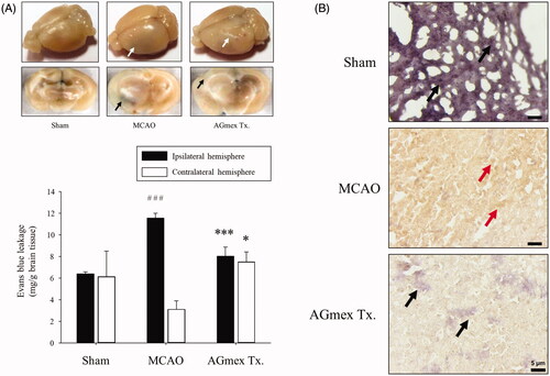 Figure 4. Effects of AGmex on blood-brain barrier (BBB) permeability and the localisation of AQP4 (aquaporin 4) protein in MCAO-induced mouse brains. (A) Representative images of EB extravasation in whole brain and coronal sections (upper column), and quantification of EB leakage in the ipsilateral (left) hemispheres and contralateral (right) hemispheres (lower column, n = 3). (B), Immunohistochemical (IHC) staining of AQP4 protein in the cerebral cortex (black arrows indicate negativity and red arrows positivity). Scale bars: 5 µm. Results are presented as means ± SDs (n = 3). ###p < 0.001 vs. the sham-operated group; *p < 0.05 and ***p < 0.001 vs. the MCAO group.