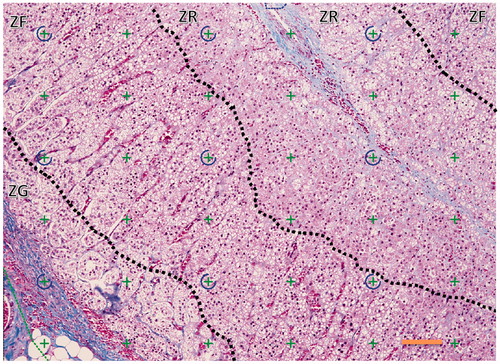 Figure 3. Example of a counting frame. 100× magnification of adrenal midsection with counting markers (crosses, every fourth cross is further marked by a semicircle for better orientation) overlaid. All three cortical zones are visible, but the medulla is not. Approximate zone borders marked by dotted lines. ZG: zona glomerulosa; ZF: zona fasciculata, ZR: zona reticularis. Masson’s Trichrome stain. Scale bar = 100 μm.