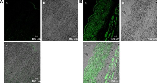 Figure 5 A tile scan confocal laser scanning microscope photomicrographs of (A) longitudinal section of rat skin treated with 1% FDA solution and (B) fluorolabeled TEs: (a) fluorescence light, (b) transmitted light, and (c) merge between fluorescence light and transmitted light.Abbreviations: FDA, fluorescein diacetate; TEs, transethosomes.