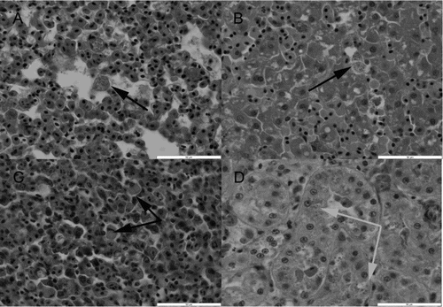 Figure 1. Histological appearance of issues from a yellow-eyed penguin (M. antipodes) that died with typical lesions of pulmonary, hepatic and splenic erythrophagocytosis and mild haemosiderosis. (a) The lung shows marked congestion with varying degrees of pulmonary oedema, and an accumulation of macrophages that contain finely granular to clumpier golden-brown intracytoplasmic pigment/material (black arrow). (b) The liver demonstrates increased numbers of Kupffer cells, with many containing similar pigment/material to that observed within the lung (black arrow) which was confirmed as iron with Perls’ Prussian Blue stain. (c) The spleen also shows increased numbers of histiocytic-like cells, many of which contained pigment/material similar to that seen in the lung and liver. In addition, in several of the better preserved sections of spleen, these cells appeared to contain swollen erythrocytes (black arrows). (d) The histological appearance of the kidney showing typical pathology of swelling and vacuolation of the proximal and distal renal tubular epithelial cells, associated with intracytoplasmic eosinophilic droplets resembling haemoglobin within the epithelial cells (grey arrows). Haematoxylin and eosin stain. Scale bars represent 50 μm.