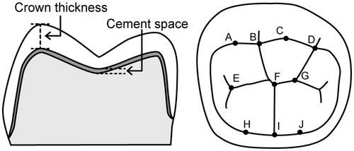 Figure 1. Schematic representation of measuring points in micro-CT analysis. Crown thickness and cement space were measured as the vertical distance at 10 different points (A–J). The minimal occlusal thickness was obtained at B, F and I.