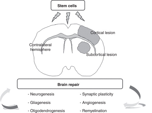 Figure 1. Stem cell administration enhances brain repair mechanisms after cerebral infarct. Cell therapy is an attractive therapeutic approach to enhance brain plasticity that improves neurogenesis, gliagenesis, oligodendrogenesis, remyelination, synaptic plasticity and angiogenesis, not only in gray but also in the white matter. Additionally, stem cells are able to stimulate compensatory processes in the contralateral hemisphere after stroke.