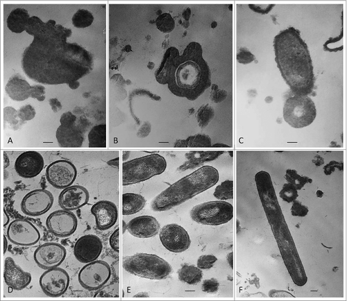 Figure 5. TEM of L-form cells from blood isolate No1 grown in semisolid agar: (A-C) cell wall deficient cells observed during the first phase/week of cultivation; (D-F) heterogeneous population of reverting bacteria with partially or fully recovered cell walls found during the second phase/week of cultivation.