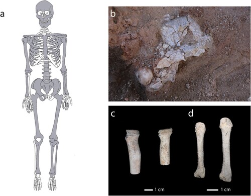 Figure 14 Remains of an individual found in Locus 16/Q/79: a) schematic diagram that shows which skeletal elements were recovered (in grey); b) in situ photo of the individual’s right pelvis and femoral head; c) proximal ends of right (on left) and left (on right) radii, showing differential size and colouration; and d) left (on left) and right (on right) fourth metacarpals, showing differential size and colouration (courtesy of the Megiddo Expedition).