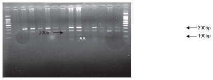 Figure 2 Polymerase chain reaction restriction fragment length polymorphism results of SDF1 followed by enzymatic digestion on 1.5% agarose gel (genotypes observed, A/A and A/G).