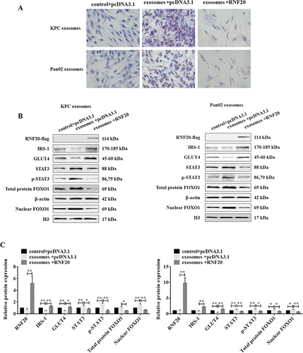 Figure 5 Overexpression of RNF20 reverses PC cell-derived exosome-induced insulin resistance. (A) Oil Red O staining assay of lipid accumulation in C2C12 myotube cells treated with exosomes or co-overexpressed RFN20, the red part indicates the stained lipid particles. (B) Western blotting results of the expression of RNF20, IRS-1, GLUT4, STAT3, p-STAT3, total protein FOXO1 and nuclear FOXO1; (C) quantitative analysis of protein band, β-actin was used as a control of total protein. *P<0.05, **P<0.01.