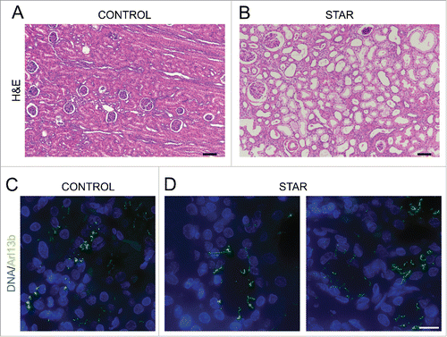 Figure 6. Renal tubules of a STAR patient are dilated and exhibit longer cilia (A, B) Histopathological analysis (H&E staining) of renal biopsies from a CONTROL (A) and a STAR patient (B). Scale bar, 100 μm. (C, D) Immunofluorescent visualization of primary cilia (Arl13b staining, shown in green) and DNA (DAPI staining, shown in blue) in renal tubules from a CONTROL (C) and a STAR patient (D). Scale bar, 15 μm.
