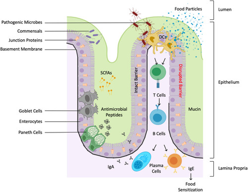 Figure 2 Immunity-microbiome crosstalks at gastrointestinal tract. Schematic diagram depicting the gut mucosa illustrated with the various structural and immunological barriers and defenses. The intestinal mucosa consists of an epithelial layer lined by an inner mucus layer and an underlying lamina propria. The epithelial layer forms a physical barrier, facilitated by intracellular tight junctions, various cell types and their secretory products. Paneth cells produce protective antimicrobial peptides, while goblet cells produce mucin, the major component of the mucus coating. The mucus layer is rich in microbial colonies, which can synthesize immunomodulatory molecules such as SCFAs. The lamina propria are rich in immune cells that play a fundamental role in immune surveillance. Dendritic cells transmit environmental signals to activated plasma cells to produce protective secretory immunoglobulin A (sIgA). A leaky intestinal barrier can lead to displaced food antigens in the lamina propria, which in turn can activate Th2 Cell and class-switch B cells to produce specific immunoglobulin E (sIgE) production, causing sensitization to food allergens.