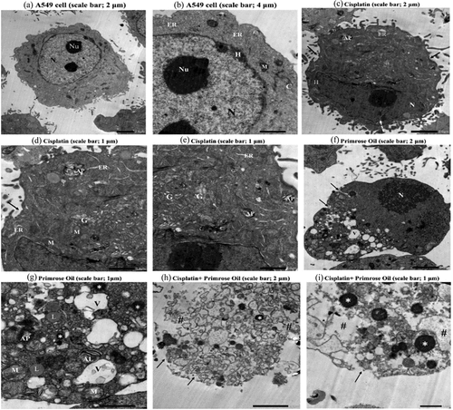 Figure 4. Transmission Electron Microscopy (TEM) micrographs of A549 lung cancer cell illustrating ultrastructural features of control cell (a and b) showing intact cell membrane and centric large nucleus (N) with obvious nucleoli (NU) surrounded by regular nuclear membrane. Normal distribution of heterochromatin (H) and cellular organelles in cytoplasm including pleomorphic mitochondria (M), endoplasmic reticulum (ER), and cytoskeleton (c)are noticed. Cisplatin group (c-e) showing irregular plasma membrane, deeply invaginated nucleus (dash-arrow) with chromatin condensation (H) at the periphery of the nuclear membrane. Rod-shaped mitochondria (M) dilated endoplasmic reticulum (ER), high incidence of autophagosome (AP) and Golgi apparatus fragmentation (G) are observed. Primrose oil group (f and g) showing invaginated plasma membrane (↑), oval pyknotic nucleus (N), swollen destructive mitochondria (M), and heavily vacuolized cytoplasm (V) with the presence of autophagosomes (AP) and autolysosome (AL). Increased number of apoptotic bodied (*) and lipid droplets (L) are detected. Cisplatin and primrose oil group (h and i) showing severe cell damage with ruptured cell membrane (↑), complete cytoplasmic dissolution (#) and frequent apoptotic bodies (*).