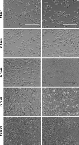 Figure S6 Bright-field images of cells seeded in eight-well Lab-Tek chambered coverslips at 50,000 cells/well in 0.3 mL medium at 24-hour time points before study start.Notes: Two representative images are shown per time point. Medium was replaced 24 hours after seeding (denoted “0 hour”) with fresh full medium, but not replaced after this for the duration of the study. Cell morphology and growth and medium color were monitored. Scale bars set at 200 µm.