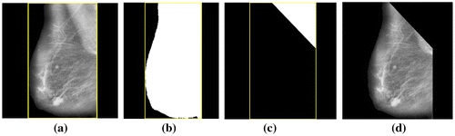 Figure 2. (a) Bounding box of the breast contour of the enhanced mammogram image mdb005 (b) The binary mask of the breast contour (c) Binary mask of the upper triangle of the bounding box and (d) Final image with pectoral muscles removed.