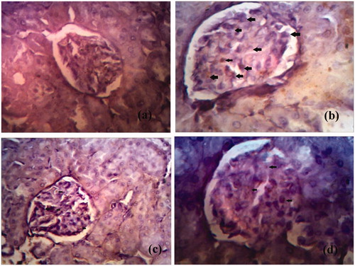 Figure 6. Immunohistochemistry pictures of apoptotic cells in kidney tissue of different groups. Brown stained cells are undergoing apoptosis. Arrowheads represent the expression of TUNEL positive apoptotic cells. (a) Represents normal control. (b) Represents diabetic control. (c) Represents naringenin (5 mg/kg) treated rat. (d) Represents naringenin (10 mg/kg) treated rat. (H&E × 200; scale bars = 50 μm).
