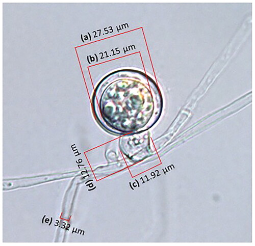 Figure 2. Measuring diameters of (a) oogonium and (b) oospore, (c) width and (d) height of antheridium, and (e) diameter of hypha of isolate HSv10 used in this study with a differential interference-contrast light microscope.