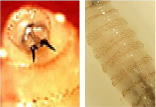Figure 7 Mouth hooks with cuticular spines around body of larvae.