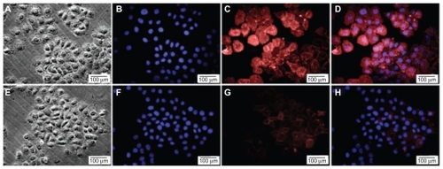 Figure 3 Expression of CD44 was decreased after transfection with CD44 siRNA. The CD44+CD24− cells strongly expressed CD44 protein (A, B, C, D) and CD44 was weakly expressed after knockdown (E, F, G, H). A, E) cells before and after siRNA transfection. B, F) nuclei were stained with Hoescht 33342. C, G) cells were stained with anti-CD44 antibody. D) merged picture of B and C. H) merged picture of F and G.