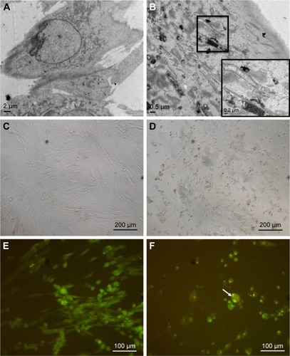 Figure 2 Cellular uptake of ZnO NPs and morphological changes in treated human MRC5 lung fibroblasts.Notes: (A) EM micrograph of untreated MRC5 lung fibroblast. (B) EM micrograph of ZnO NP-treated MRC5 lung fibroblast. (C) LM micrograph of untreated MRC5 lung fibroblast. Magnification: ×100. (D) LM micrograph of 50 μg/mL ZnO NP-treated cells. Cells are shrunken, indicative of cell death. Magnification: ×100. (E) Confocal micrograph of untreated MRC5 cell. Magnification: ×200. (F) Confocal micrograph of cells treated with 25 μg/mL ZnO NPs, showing cell shrinkage (as indicated by arrow). Magnification: ×200.Abbreviations: EM, electron microscope; NPs, nanoparticles; LM, light microscope.