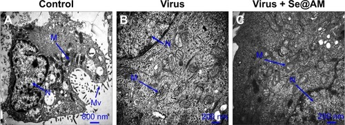 Figure 10 TEM images of thin sections of MDCK cells treated with different groups.Notes: (A) Control, (B) cells treated with virus, and (C) cells treated with virus + Se@AM at 24 h.Abbreviations: AM, amantadine; MDCK, Madin–Darby Canine Kidney; Se@AM, AM-modified SeNPs; SeNPs, selenium nanoparticles; TEM, transmission electron microscopy; N, nucleus; M, mitochondria; Mv, microvilli.