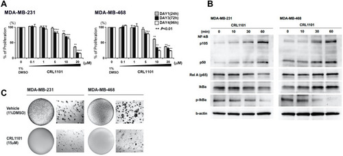 Figure 5 Anti-tumor effects of CRL1101 in TNBC: (A) Anti-proliferation effects of CRL1101. Cells were treated with different concentations of CRL1101, as shown in figure. Proliferation of the cells were investigated by MTT assay at 24, 72 and 96 h after CRL1101 treatment. Proliferation was inhibited in a dose-dependent manner (**P<0.01). (B) Time series of the effects of CRL1101 on expression and activation of NF-κB and related molecules by Western blot analysis. The effects of 15µM of CRL1101 on NF-κB signal related molecules, p105, p50, RelA, IκBα and p- IκBα, is shown after 0, 10, 30 and 60 minutes in MDA-MB-231 and MDA-MB-468 cells. β-actin was used as an internal expression standard. (C) Inhibition of tumor growth by anchorage independent growth assay. The effects of CRL1101 on clonogenic survival is shown after 24 h. CRL1101 inhibited colony formation in MDA-MB-231 and MDA-MB-468 cells after cells were treated with 15µM of CRL1101.