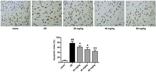 Figure 3. GJ represses apoptosis of ischemic tissues in I/R rats. MCAO/R rats were constructed and treated with GJ at indicated doses (n = 6). The apoptosis of cerebral cortex tissues was analyzed by TUNEL staining. * P < 0.05, ** P < 0.01, ## P < 0.01. Data are presented as mean ± SD.