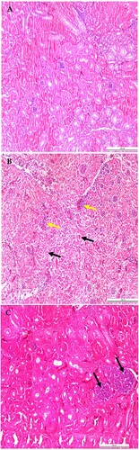 Figure 5. Microscopic lesions in kidneys of CAstV- infected and exposed sentinel chickens at 6 and 9 dpi. (A) Normal kidney control. (B) Urate deposits (black arrows) and interstitial inflammatory infiltrates (yellow arrows) with compressed glomeruli. (C) Tubular necrosis with the accumulation of cellular debris evolving into a tophus (black arrows), urate deposits, degeneration and necrosis of tubules. Stained with H & E; scale bar A, B and C = 200 μm.