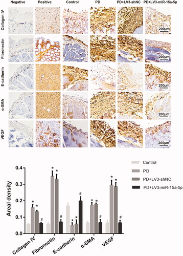 Figure 3. Immunohistochemistry was also used to analyze those factors and the results are similar to those of the western blot. *p < 0.05 versus control, #p < 0.05 versus PD.