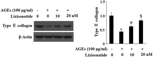 Figure 4. Lixisenatide ameliorates advanced glycation end products (AGEs)-induced degradation of type II collagen. Type II collagen was determined by western blot analysis (*, #, $, p < .01).