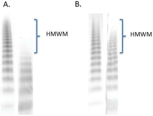 Figure 2. Loss of high molecular weight multimers (A, 1 June 2018) of von Willebrand factor (VWF) and normal multimeric structure (B, 28 December 2018) of VWF were detected by using 0.8% agarose gel electrophoresis. SDS–agarose gel electrophoresis was performed in two separate experiments according to the date of collecting blood sample from the patient, however, the same control plasma pool was used in both experiments. Lane 1, control plasma pool; Lane 2, patient’s plasma. HMWM are indicated in the figure.