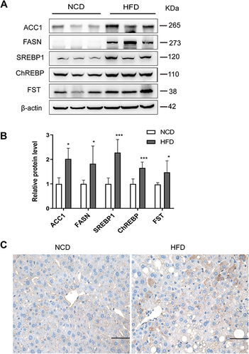 Figure 6 Hepatic FST expression increased in HFD mice. (A and B) The hepatic protein levels and analysis results of FST, ACC1, FASN, SREBP1, and ChREBP in NCD and HFD mice. β-actin was used as a loading control. (C) Immunohistochemical staining of hepatic FST in NCD and HFD mice (400×, scale bar= 50 µm).