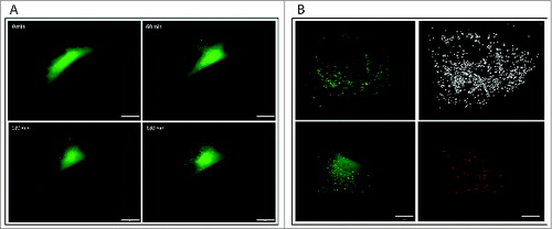 Figure 2. From a micrograph to a number. (A) Live-cell imaging of mouse embryonic fibroblasts stably expressing GFP-LC3 reveals accumulation of autophagosomes over time in the presence of bafilomycin A1. (B) Software solutions exist to assist in automated counting of the complete autophagosome pool. Scale bar: 20 μm (A) and 10 μm (B).