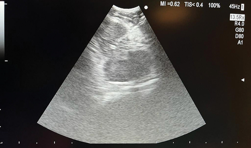 Figure 6. EUS-B image of mediastinal lymph node station 8.