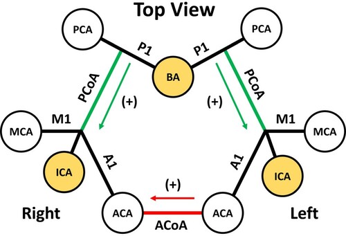 Figure 3. Schematic for CoA, namely ACoA (red), and PCoAs (green), flow directions. For analytic presentation, complete form of CoW is seen from the top showing six major cerebral arteries (white) and three source arteries (yellow) as circles. Since RICA is the site for stenosis, ACoA direction is positive towards right hemisphere, and PCoA directions are positive towards anterior hemisphere. CoA, communicating artery; RICA, right internal carotid artery; M1, proximal segment of MCA; A1, proximal segment of ACA; P1, proximal segment of PCA; ACoA, anterior communicating artery; PCoA, posterior communicating artery; ICA, internal carotid artery; VA, vertebral artery.