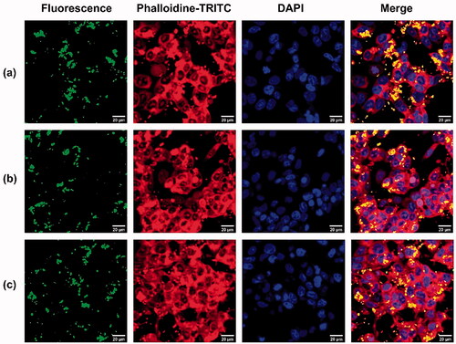 Figure 7. Confocal microscopy images of MCF7 cells (a) MCF7 cells treated with NPs/FITC, (b) MCF7 cells treated with MTX/NPs/FITC, (c) MCF7 cells treated with MTX/siRNA/NPs/FITC at 37 °C for 4 h. FITC was shown as green fluorescence, actin filaments (red) were stained with phalloidin-TRITC and cell nuclei (blue) were stained with DAPI. NPs: MSN-APTES-chitosan.