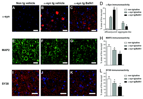 Figure 6. Neuropathological alterations in the temporal cortex of α-synuclein transgenic mice. Immunocytochemical analysis with an antibody against α-synuclein (red, top panel) showed that transgenic mice (B) displayed α-synuclein positive inclusions and punctated expression patterns compared with nontransgenic control (A). Alpha-synuclein positive inclusions were reduced by BafA1 treatment (C) compared with saline treated animals. The dendritic marker MAP2 and the synaptic marker SY38 were reduced in α-synuclein transgenic mice (F and J) compared with non-transgenic mice (E and I). ALP inhibition with BafA1 aggravated MAP2 and SY38 immunoreactivity levels (G and K). Quantitative analysis of inclusion- and punctated α-synuclein (D), MAP2 (H) and SY38 (L) immunoreactivity are displayed in the right panel. Significant changes are indicated (*) as compared with saline-treated animals (for α-synuclein immunoreactivity) or compared with saline-treated non-tg animals (for MAP2 and SY38 immunoreactivity). Scale bars: 10 µm.