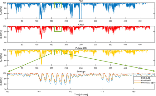 Figure 2 An example of a comparison of the nocturnal oxygen saturation signal of Circul, Pulsox 300i, and the polysomnographic (PSG) sum signal, demonstrating a series of hypoxia events in a subject with severe OSA. The amplitude of all signals has been normalized.