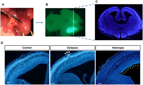 Figure 1. In utero electroporation with green-plasmid and identification of ectopias and heterotopias. (A) The embryonic mouse brains at E13.5 stage were injected with GFP-conjugated plasmid (pCAGIG) in 0.1% fast green solution and then transfected by electroporation. (B) The pCAGIG electroporated brains were harvested at E15.5 stage (48 h post-electroporation) and examined under Research Macro Zoom fluorescence system (Olympus DP72, Kanazawa-shi, Japan) for green fluorescence. (C) The rostral part of a coronal section from the injected brain was sectioned and then stained with DAPI (indicated white line from B was the magnified section that represents in C). (D) The harvested brains were sectioned and stained with DAPI to identify the Ectopia and Heterotopias. The Ectopia was indicated with white arrowheads and heterotopias were indicated by a yellow dashed line. Scale bar of the image is 100 μm.