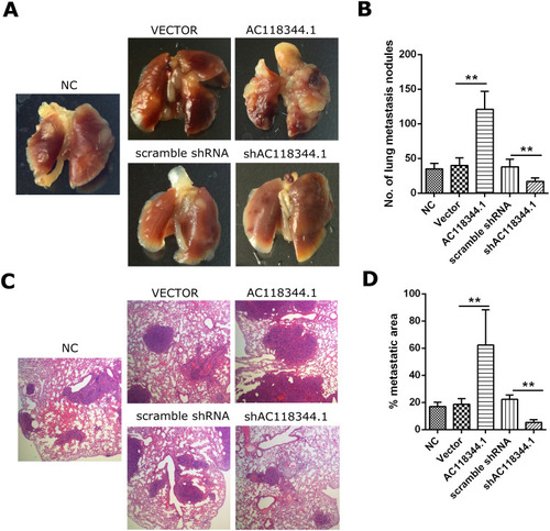 Figure 4 Overexpression of AC118344.1 promoted lung metastatic nodules in nude mice. (A) Lung metastatic burden in BALB/c nude mice; (B) the lung metastatic nodule numbers; (C) representative HE staining of metastatic foci in the lung tissues; (D) lung metastatic tumor area/total lung area. NC: Untransfected cells (wild-type cells); Vector: Transducted with pcDNA3.1+ empty vector; AC118344.1: Overexpression AC118344.1; scramble shRNA: Transfected with scramble shRNA; shAC118344.1: Transfected with AKT2 shRNA. **Indicates p < 0.01.