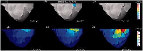 Figure 11. A two-step image guided therapeutic procedure in a heterogeneous breast phantom, using IO-based NETUS. (a) Time-of-flight based baseline projection image of the phantom. (b) A colour overlay depicting the TOF-related changes atop the baseline image, stemming from IO NPs injection (238 µg/ml concentration). The same volume of water was injected to the second target as a control, which did not alter the image as expected. (c) Another baseline image, scanned after inserting the MW antenna to the detected target borders. A Sobel edge detector was used to mark the target outline using the detected NPs location (black line). (d–f) Temperature monitoring using TOF-based changes with respect to baseline image in (c). The displayed temperatures were measured at the target zone using a sensor at the beginning of each scan.